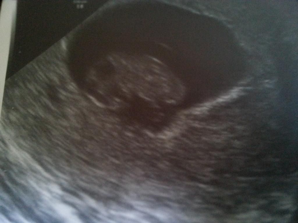 baby.jpg